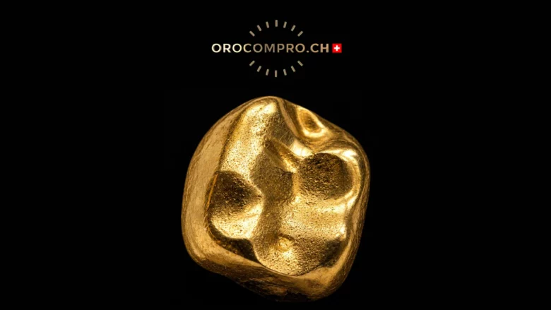 Vendere oro dentale e scarti d’oro: come calcolare il peso dell’oro puro?
